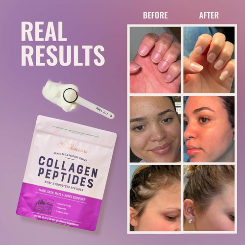 Collagen Peptides Powder - Naturally-Sourced Hydrolyzed Collagen Powder - Hair, Skin, Nail, and Joint Support - Type I & III Grass-Fed Collagen Supplements for Women and Men - 16Oz